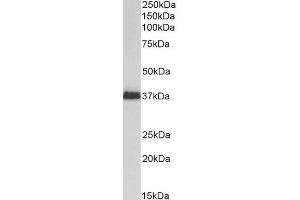 Image no. 3 for anti-Musashi Homolog 2 (MSI2) (N-Term) antibody (ABIN2613452)