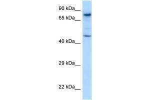 Image no. 1 for anti-SKI-Like Oncogene (SKIL) (C-Term) antibody (ABIN2779595)