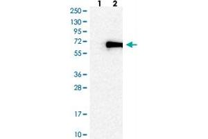 Image no. 2 for anti-Zinc Finger Protein 155 (ZNF155) antibody (ABIN5591299)