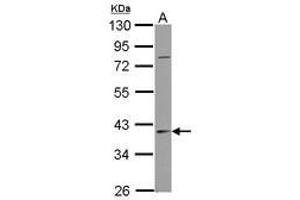 Image no. 1 for anti-serpin Peptidase Inhibitor, Clade B (Ovalbumin), Member 7 (SERPINB7) (AA 12-265) antibody (ABIN1500893)