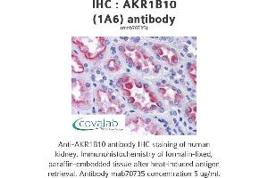 Image no. 2 for anti-Aldo-Keto Reductase Family 1, Member B10 (Aldose Reductase) (AKR1B10) (AA 76-144) antibody (ABIN1723592)