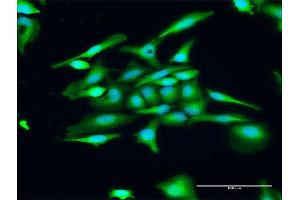 Immunofluorescence of purified MaxPab antibody to GUCA1C on HeLa cell.