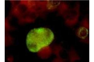 anti-Herpes Simplex Virus Type 2, Glycoprotein G (HSV2 gG) antibody