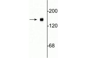 Image no. 2 for anti-Neurofilament Triplet M Protein (NEFM) (C-Term) antibody (ABIN361354)