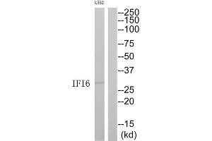 Image no. 1 for anti-Interferon, alpha-Inducible Protein 6 (IFI6) (C-Term) antibody (ABIN1852572)