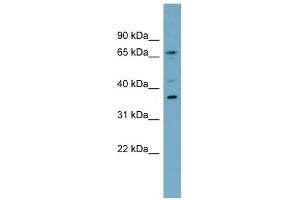 Image no. 1 for anti-Mitochondrial E3 Ubiquitin Protein Ligase 1 (MUL1) (Middle Region) antibody (ABIN2774781)