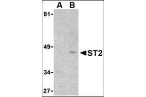 Image no. 2 for anti-Interleukin 1 Receptor-Like 1 (IL1RL1) (N-Term) antibody (ABIN500811)
