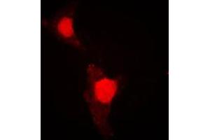 Image no. 2 for anti-Forkhead Box O1 (FOXO1) (pSer319) antibody (ABIN2706172)