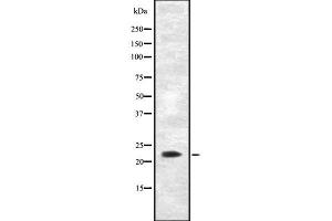 Image no. 1 for anti-Adenylate Kinase 5 (AK5) antibody (ABIN6259848)