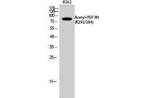 Image no. 1 for anti-Heat Shock Protein 90 (HSP90) (acLys284), (acLys292) antibody (ABIN3181886)