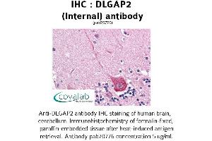Image no. 2 for anti-Discs, Large (Drosophila) Homolog-Associated Protein 2 (DLGAP2) (Internal Region) antibody (ABIN1733676)