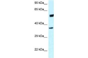 Image no. 1 for anti-Homer Homolog 3 (Drosophila) (HOMER3) (C-Term) antibody (ABIN2789049)