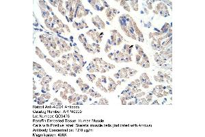 Image no. 1 for anti-Aconitase 1 (ACO1) (N-Term) antibody (ABIN2778793)