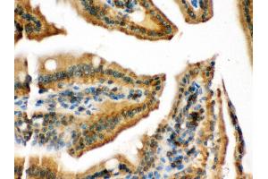 Anti- RAB13 Picoband antibody, IHC(P) IHC(P): Mouse Intestine Tissue