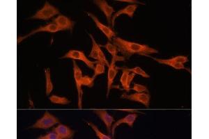 Immunofluorescence analysis of HeLa cells using LGMN Polyclonal Antibody at dilution of 1:100 (40x lens).