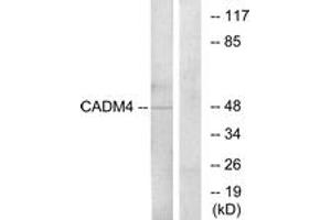 Image no. 2 for anti-Cell Adhesion Molecule 4 (CADM4) (AA 339-388) antibody (ABIN1534303)