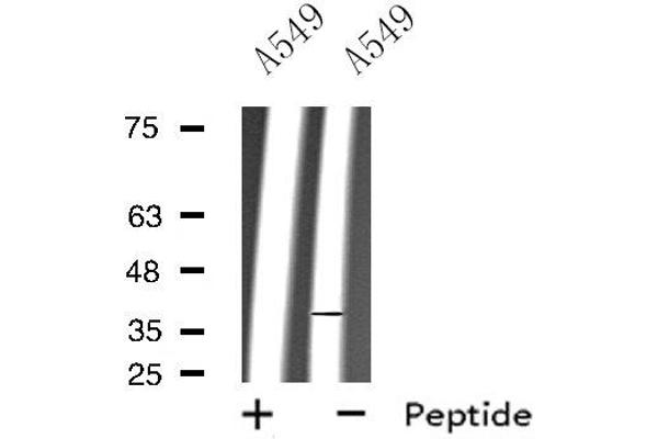 Rho-related GTP-binding protein antibody