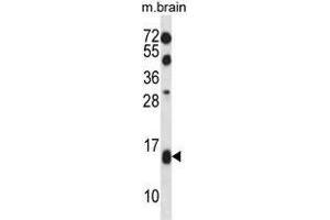 Image no. 1 for anti-Transcription Elongation Factor B (SIII), Polypeptide 2 (18kDa, Elongin B) (TCEB2) (AA 1-29), (N-Term) antibody (ABIN955125)
