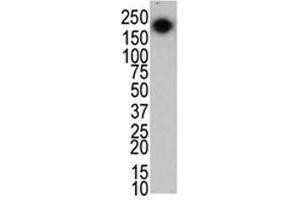 Image no. 1 for anti-Leucine-Rich Repeat Kinase 2 (LRRK2) (C-Term) antibody (ABIN3031611)