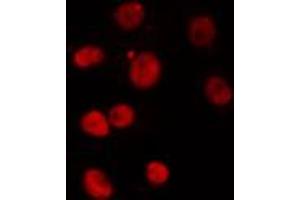 Image no. 1 for anti-Paired-Like Homeodomain 1 (PITX1) antibody (ABIN6259152)