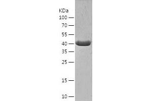 ACAA1 Protein (AA 27-424) (His tag)