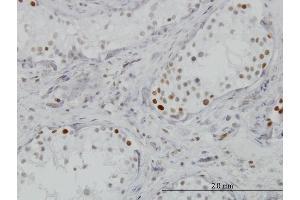 Image no. 1 for anti-Bromodomain Containing 3 (BRD3) (AA 418-556) antibody (ABIN563516)