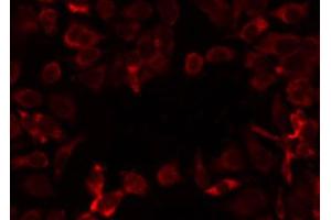 Image no. 1 for anti-Mitochondrial Ribosomal Protein L12 (MRPL12) antibody (ABIN6257349)