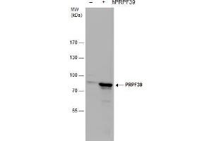 Image no. 3 for anti-Pre-mRNA Processing Factor 39 (PRPF39) (Internal Region) antibody (ABIN2856000)