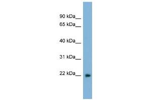 WB Suggested Anti-LBX2 Antibody Titration:  0.
