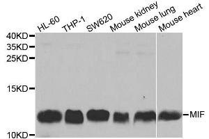 Image no. 2 for anti-Macrophage Migration Inhibitory Factor (Glycosylation-Inhibiting Factor) (MIF) antibody (ABIN3021945)