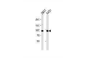 Image no. 1 for anti-Interleukin 4 Receptor (IL4R) (AA 677-691), (C-Term) antibody (ABIN1944783)