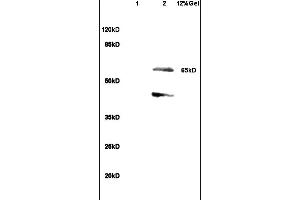 Image no. 1 for anti-SHC (Src Homology 2 Domain Containing) Transforming Protein 3 (SHC3) (AA 501-594) antibody (ABIN715661)