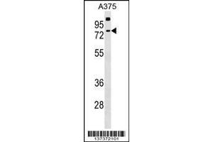 Image no. 1 for anti-Transketolase-Like 2 (TKTL2) (AA 43-71), (N-Term) antibody (ABIN1539379)