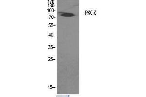 Image no. 2 for anti-Protein Kinase C, zeta (PRKCZ) (Thr33) antibody (ABIN3186477)
