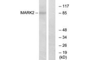 Image no. 1 for anti-MAP/microtubule Affinity-Regulating Kinase 2 (MARK2) (AA 10-59) antibody (ABIN1533969)