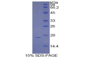 Image no. 1 for Sucrase-Isomaltase (Alpha-Glucosidase) (SI) protein (ABIN3011757)