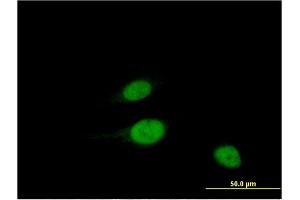 Image no. 1 for anti-Williams Beuren Syndrome Chromosome Region 22 (WBSCR22) (AA 1-110) antibody (ABIN530242)
