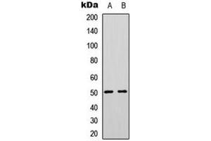 Image no. 3 for anti-Protein tyrosine Phosphatase, Non-Receptor Type 1 (PTPN1) (N-Term) antibody (ABIN2707719)