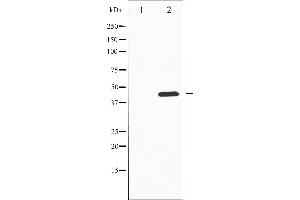 Image no. 3 for anti-Tyrosine Hydroxylase (TH) (pSer19) antibody (ABIN6255056)