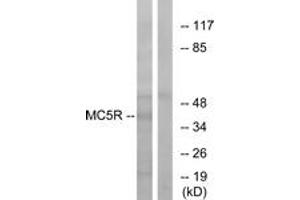 Image no. 1 for anti-Melanocortin 5 Receptor (MC5R) (AA 271-320) antibody (ABIN1535770)