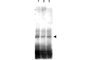 Image no. 1 for anti-CD151 (CD151) (AA 26-35) antibody (ABIN129681)