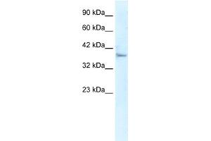 Image no. 1 for anti-Kelch-Like 14 (KLHL14) (N-Term) antibody (ABIN2775947)