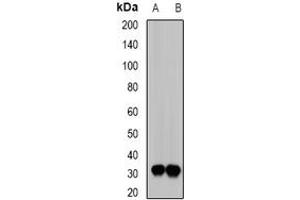 Image no. 2 for anti-E3 Ubiquitin-Protein Ligase SIAH1 (SIAH1) (full length) antibody (ABIN6005012)