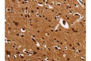 The image is immunohistochemistry of paraffin-embedded Human brain tissue using ABIN7131549(UPK3B Antibody) at dilution 1/25.