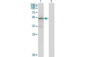 Image no. 1 for anti-Tenascin XB (TNXB) (AA 1-673) antibody (ABIN563220)