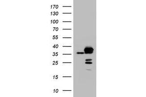 Image no. 1 for anti-Apurinic/Apyrimidinic Endonuclease 1 (APEX1) (AA 1-242) antibody (ABIN1490625)