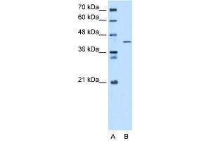 Image no. 1 for anti-Selenophosphate Synthetase 1 (SEPHS1) (C-Term) antibody (ABIN2783485)