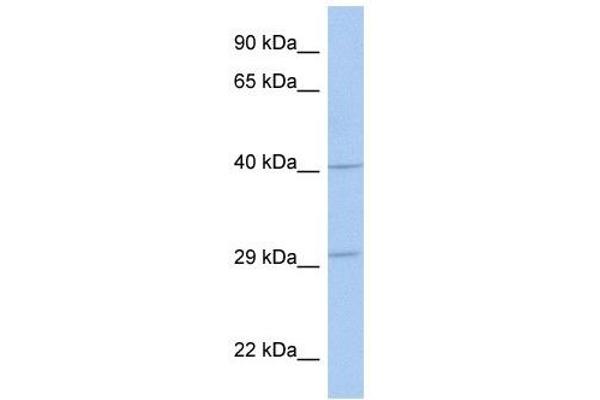 anti-ADP-Ribosyltransferase 5 (ART5) (Middle Region) antibody
