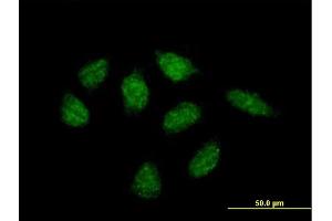 anti-Membrane-Associated Ring Finger (C3HC4) 10, E3 Ubiquitin Protein Ligase (MARCH10) (AA 1-657) antibody