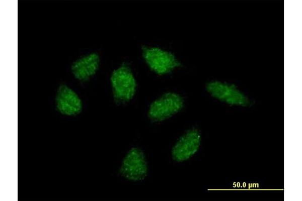 anti-Membrane-Associated Ring Finger (C3HC4) 10, E3 Ubiquitin Protein Ligase (MARCH10) (AA 1-657) antibody